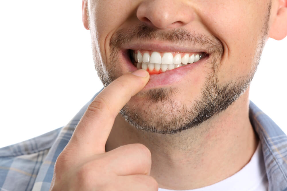 teeth treatment