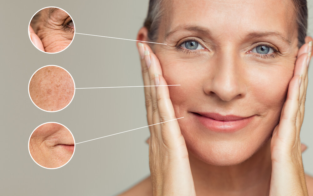 Premature Skin Aging